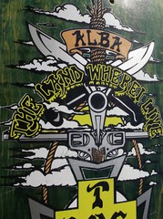 1988 DOGTOWN MICKE MALBA ALBA «LAND WHERE I LIVE» SKATEBOARD DECK RARE